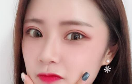 全切雙眼皮案例